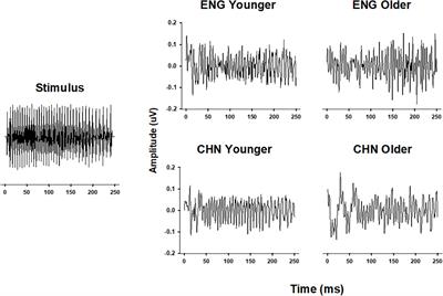 Aging Affects Subcortical Pitch Information Encoding Differently in Humans With Different Language Backgrounds